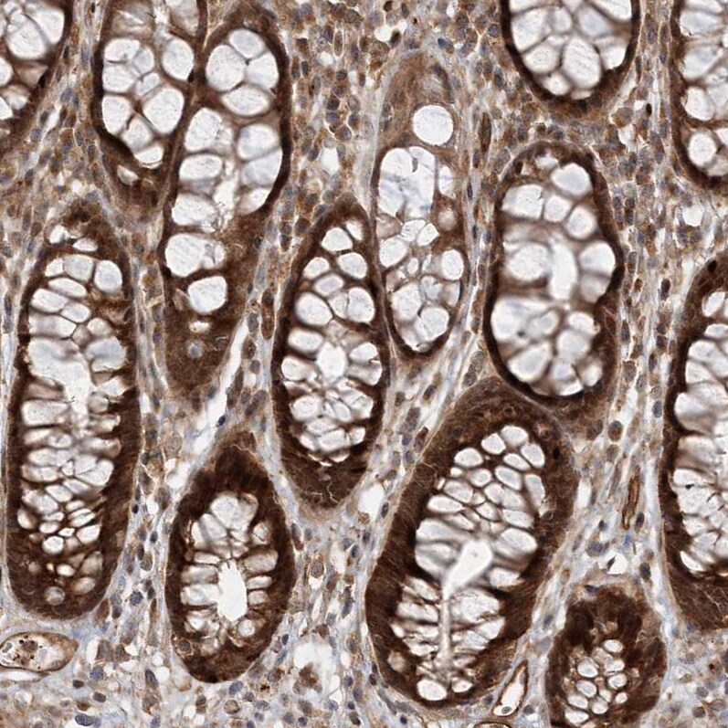Gemin 5 Antibody - BSA Free Immunohistochemistry: Gemin 5 Antibody - BSA Free [NBP1-90354]