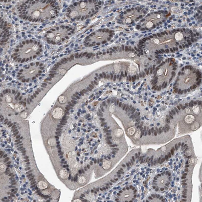 Menin Antibody - BSA Free Immunohistochemistry: Menin Antibody - BSA Free [NBP1-90357]