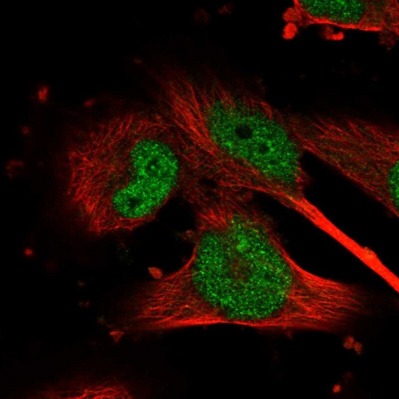 GSK-3 beta Antibody - BSA Free Immunocytochemistry/ Immunofluorescence: GSK-3 beta Antibody [NBP1-90359]