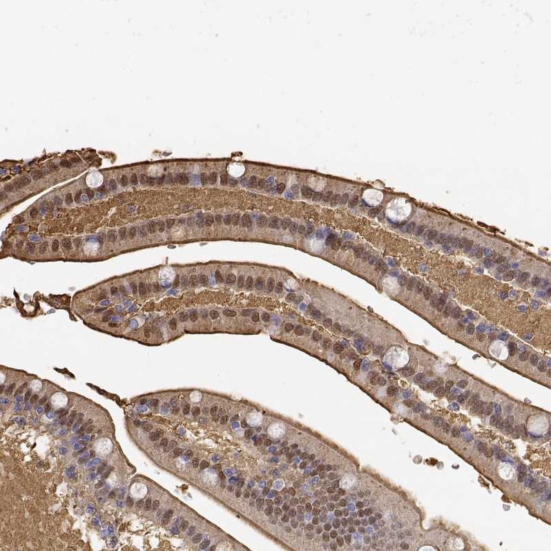 Adenosine Deaminase/ADA Antibody - BSA Free Immunohistochemistry: Adenosine Deaminase/ADA Antibody - BSA Free [NBP1-90361]