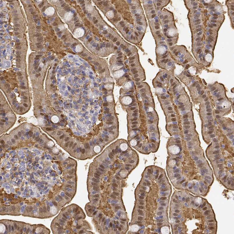 Adenosine Deaminase/ADA Antibody - BSA Free Immunohistochemistry: Adenosine Deaminase/ADA Antibody - BSA Free [NBP1-90361]