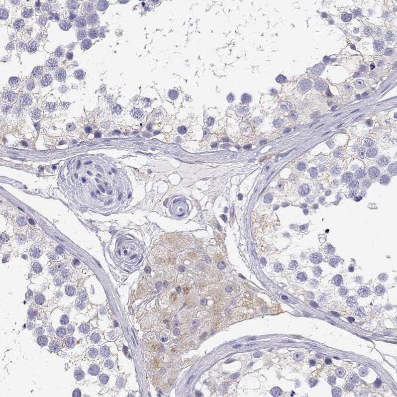 Adenosine Deaminase/ADA Antibody - BSA Free Immunohistochemistry: Adenosine Deaminase/ADA Antibody - BSA Free [NBP1-90361]