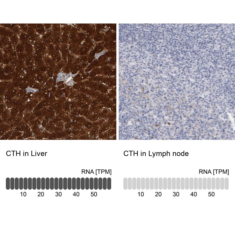 Cystathionase Antibody - BSA Free Immunohistochemistry: Cystathionase Antibody - BSA Free [NBP1-90362]