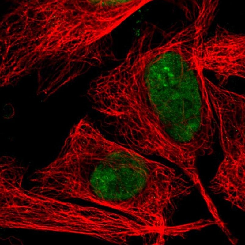 Topoisomerase I Antibody - BSA Free Immunocytochemistry/ Immunofluorescence: Topoisomerase I Antibody - BSA Free [NBP1-90365]