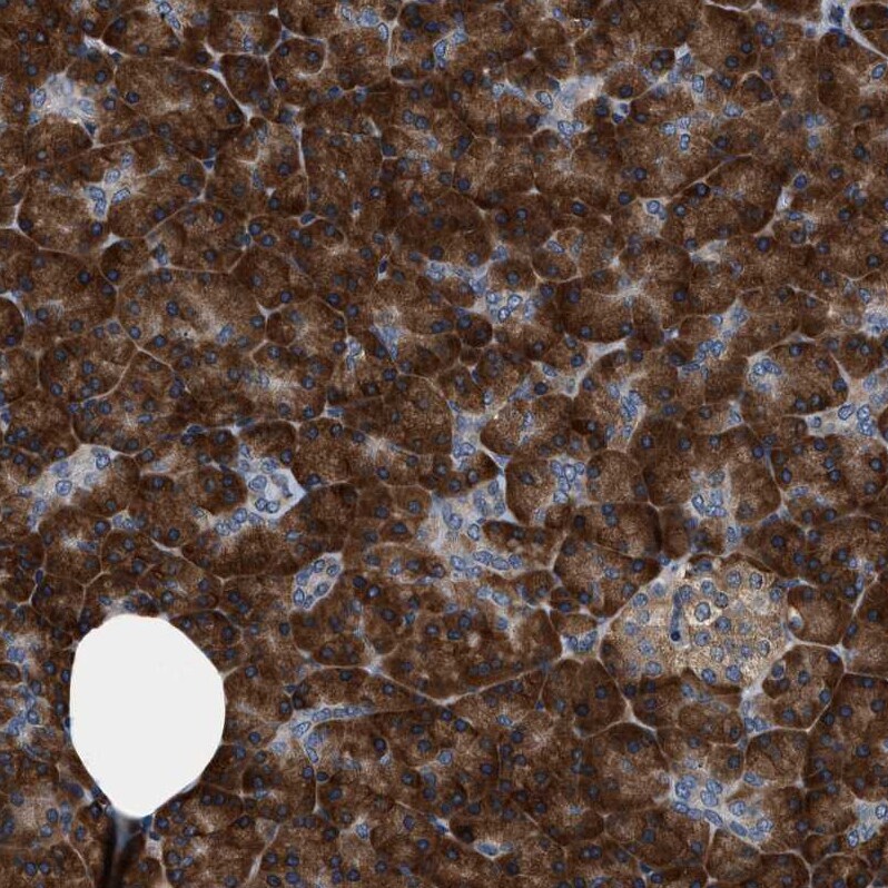 PA2G4/EBP1 Antibody - BSA Free Immunohistochemistry: PA2G4/EBP1 Antibody - BSA Free [NBP1-90369]