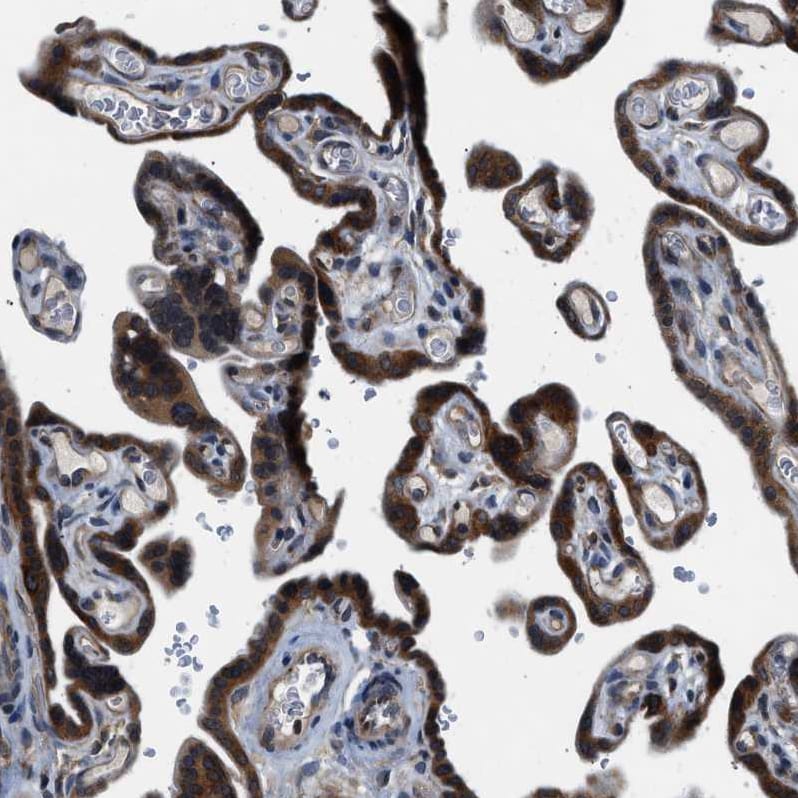 PA2G4/EBP1 Antibody - BSA Free Immunohistochemistry: PA2G4/EBP1 Antibody - BSA Free [NBP1-90369]