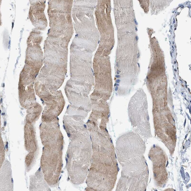 PA2G4/EBP1 Antibody - BSA Free Immunohistochemistry: PA2G4/EBP1 Antibody - BSA Free [NBP1-90369]