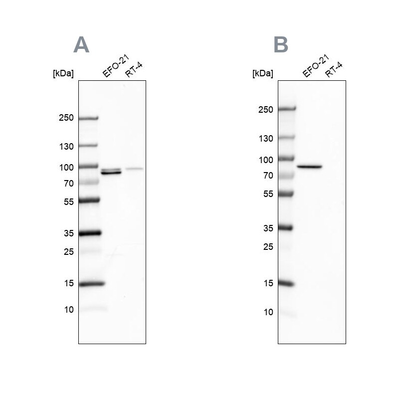 Moesin Antibody - BSA Free Western Blot: Moesin Antibody - BSA Free [NBP1-90372]