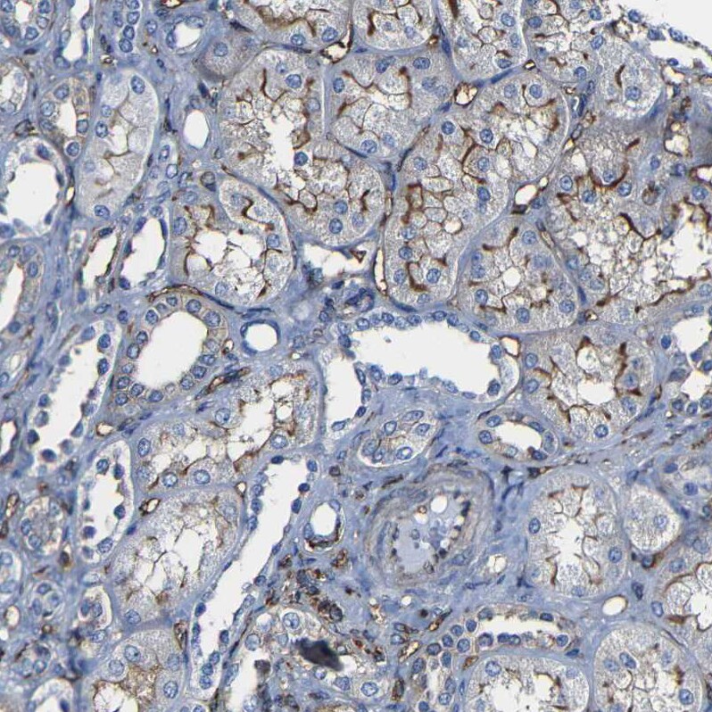 Moesin Antibody - BSA Free Immunohistochemistry: Moesin Antibody - BSA Free [NBP1-90373]