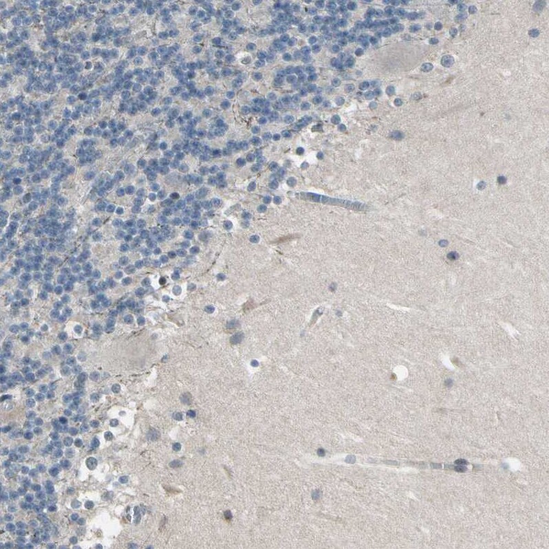 N myc interactor Antibody - BSA Free Immunohistochemistry: N myc interactor Antibody - BSA Free [NBP1-90374]