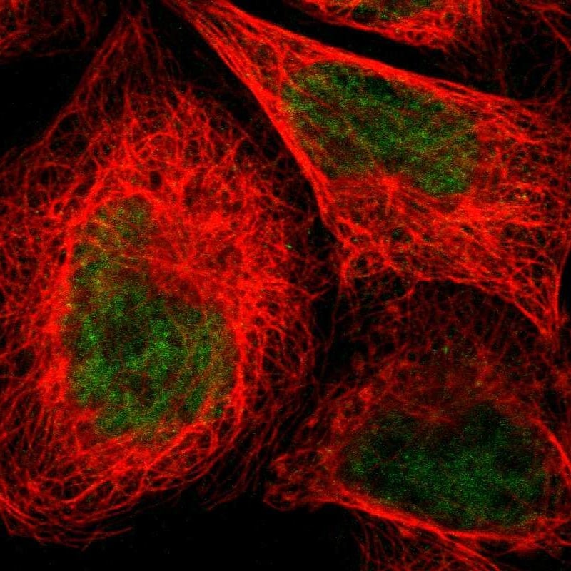 N myc interactor Antibody - BSA Free Immunocytochemistry/ Immunofluorescence: N myc interactor Antibody - BSA Free [NBP1-90374]