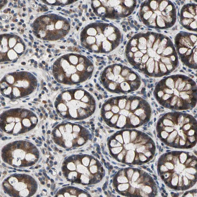 N myc interactor Antibody - BSA Free Immunohistochemistry: N myc interactor Antibody - BSA Free [NBP1-90374]