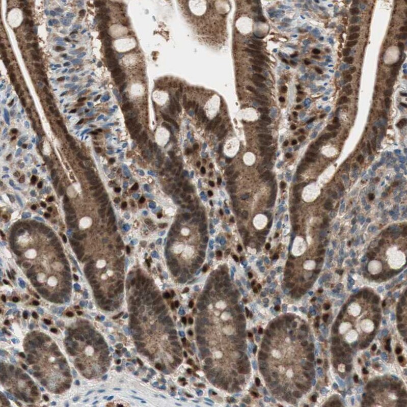 Leukotriene A4 Hydrolase/LTA4H Antibody - BSA Free Immunohistochemistry: Leukotriene A4 Hydrolase/LTA4H Antibody - BSA Free [NBP1-90375]