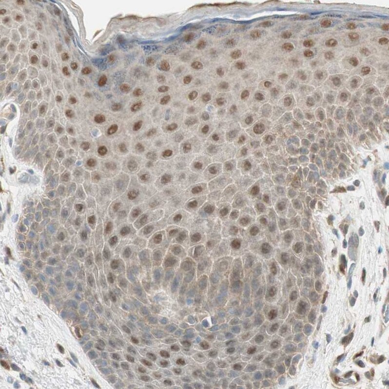 Leukotriene A4 Hydrolase/LTA4H Antibody - BSA Free Immunohistochemistry: Leukotriene A4 Hydrolase/LTA4H Antibody - BSA Free [NBP1-90375]