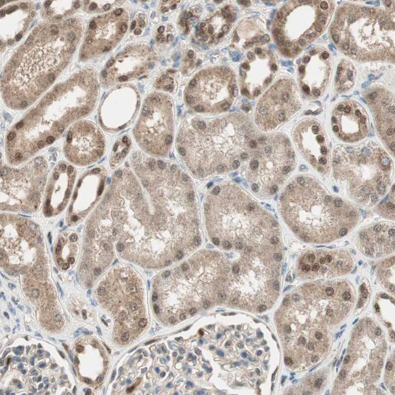 Leukotriene A4 Hydrolase/LTA4H Antibody - BSA Free Immunohistochemistry: Leukotriene A4 Hydrolase/LTA4H Antibody - BSA Free [NBP1-90375]