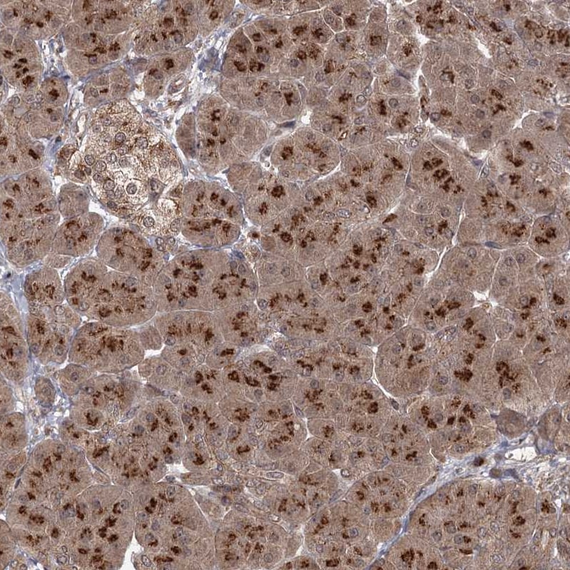 TBC1D23 Antibody - BSA Free Immunohistochemistry: TBC1D23 Antibody - BSA Free [NBP1-90421]