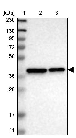 TMEM19 Antibody - BSA Free Western Blot: TMEM19 Antibody - BSA Free [NBP1-90422]