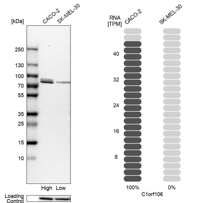 INAVA Antibody - BSA Free Western Blot: INAVA Antibody - BSA Free [NBP1-90424]