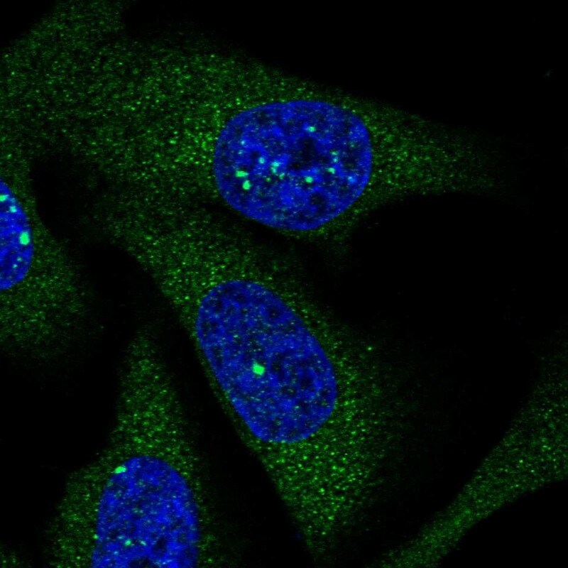 LARS Antibody - BSA Free Immunocytochemistry/ Immunofluorescence: LARS Antibody [NBP1-90430]
