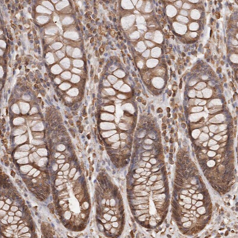 ARHGEF10L Antibody - BSA Free Immunohistochemistry: ARHGEF10L Antibody - BSA Free [NBP1-90431]