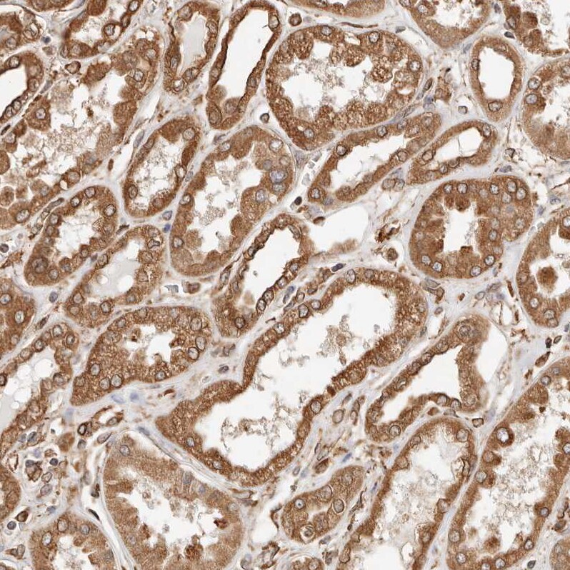 ARHGEF10L Antibody - BSA Free Immunohistochemistry: ARHGEF10L Antibody - BSA Free [NBP1-90431]