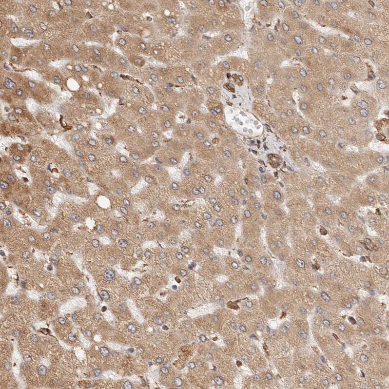 ARHGEF10L Antibody - BSA Free Immunohistochemistry: ARHGEF10L Antibody - BSA Free [NBP1-90431]