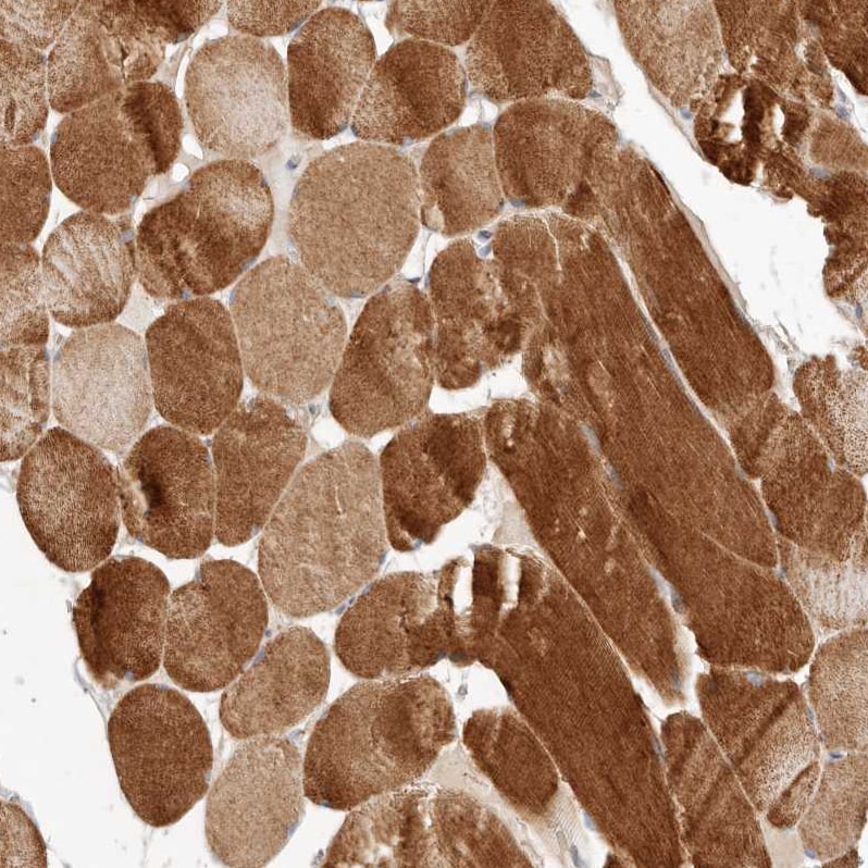 ARHGEF10L Antibody - BSA Free Immunohistochemistry: ARHGEF10L Antibody - BSA Free [NBP1-90433]