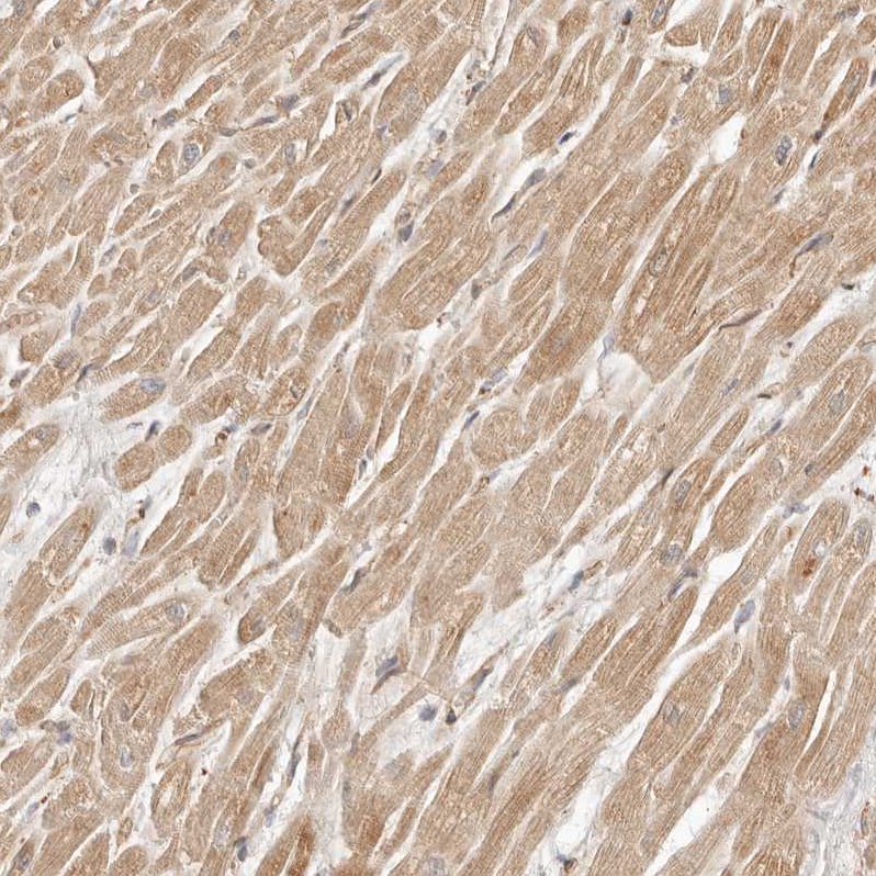 ARHGEF10L Antibody - BSA Free Immunohistochemistry: ARHGEF10L Antibody - BSA Free [NBP1-90433]