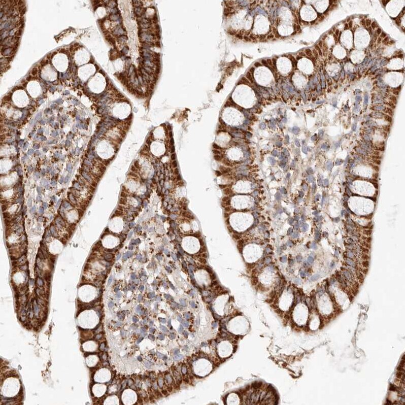 ARHGEF10L Antibody - BSA Free Immunohistochemistry: ARHGEF10L Antibody - BSA Free [NBP1-90433]