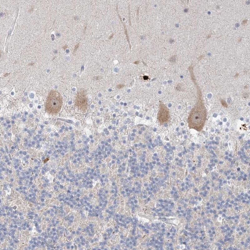 SDAD1 Antibody - BSA Free Immunohistochemistry-Paraffin: SDAD1 Antibody [NBP1-90434]
