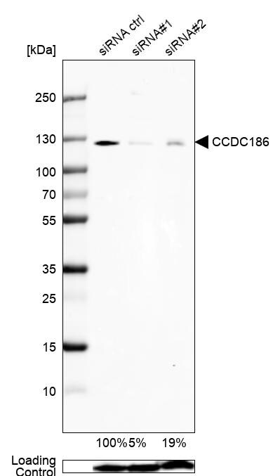 CCDC186 Antibody - BSA Free Western Blot: CCDC186 Antibody - BSA Free [NBP1-90440]
