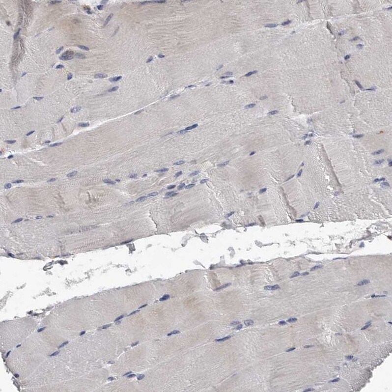 KIF26B Antibody - BSA Free Immunohistochemistry: KIF26B Antibody - BSA Free [NBP1-90446]