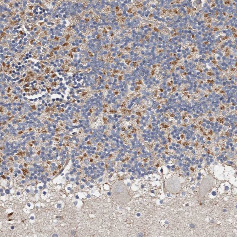 KIF26B Antibody - BSA Free Immunohistochemistry: KIF26B Antibody - BSA Free [NBP1-90446]
