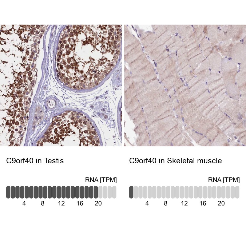 C9orf40 Antibody - BSA Free Immunohistochemistry: C9orf40 Antibody - BSA Free [NBP1-90447]