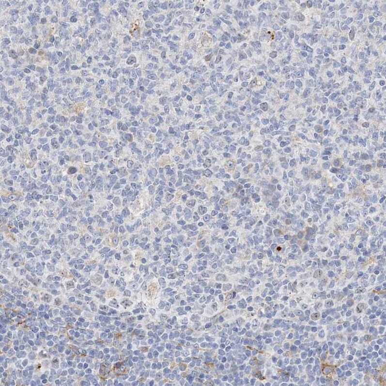 PEAR1 Antibody - BSA Free Immunohistochemistry-Paraffin: PEAR1 Antibody [NBP1-90449]