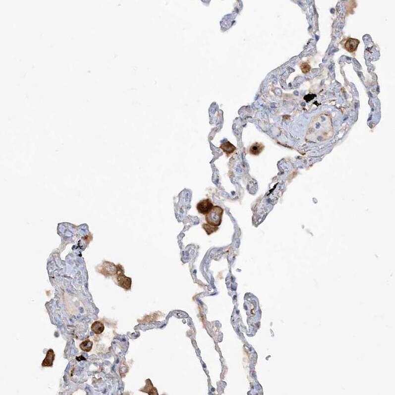 PEAR1 Antibody - BSA Free Immunohistochemistry-Paraffin: PEAR1 Antibody [NBP1-90449]