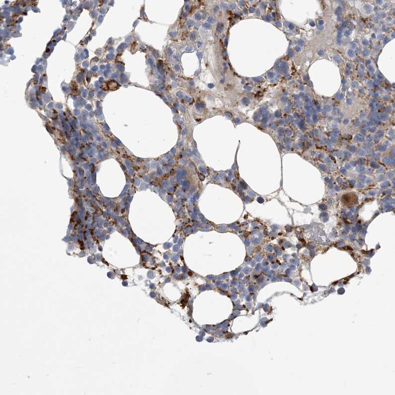 PEAR1 Antibody - BSA Free Immunohistochemistry-Paraffin: PEAR1 Antibody [NBP1-90449]