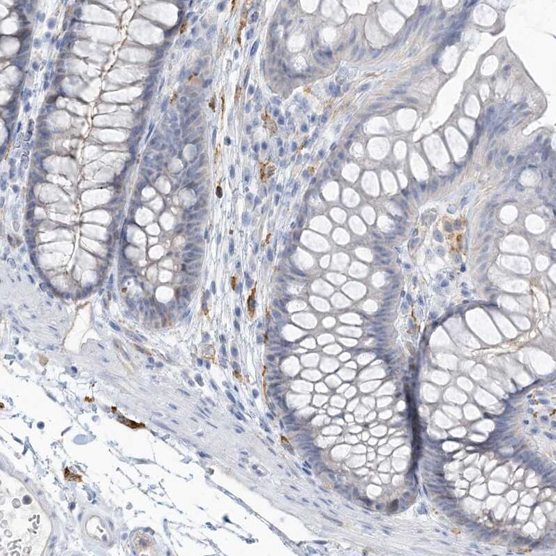 PEAR1 Antibody - BSA Free Immunohistochemistry-Paraffin: PEAR1 Antibody [NBP1-90449]