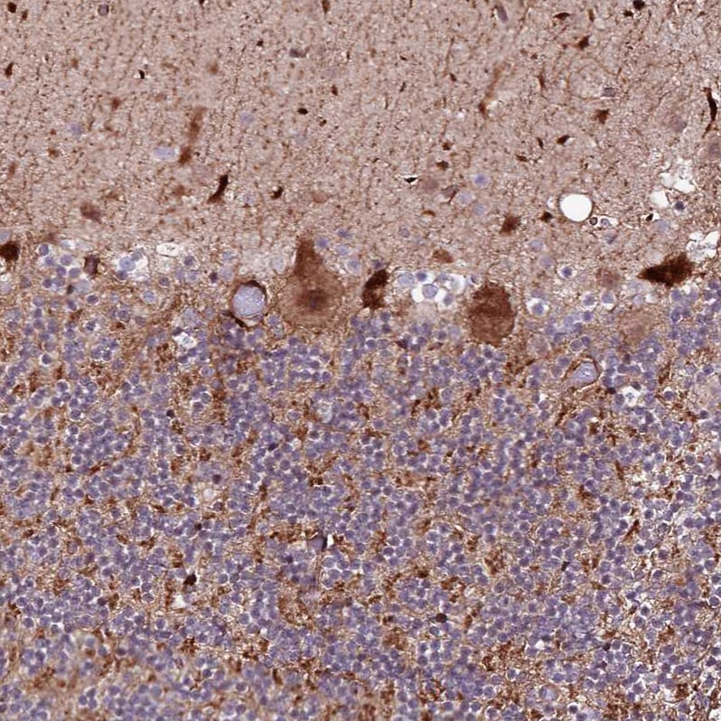 PHLDB1 Antibody - BSA Free Immunohistochemistry: PHLDB1 Antibody - BSA Free [NBP1-90451]