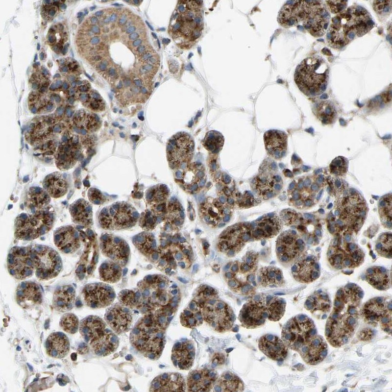 YIPF2 Antibody - BSA Free Immunohistochemistry: YIPF2 Antibody - BSA Free [NBP1-90458]