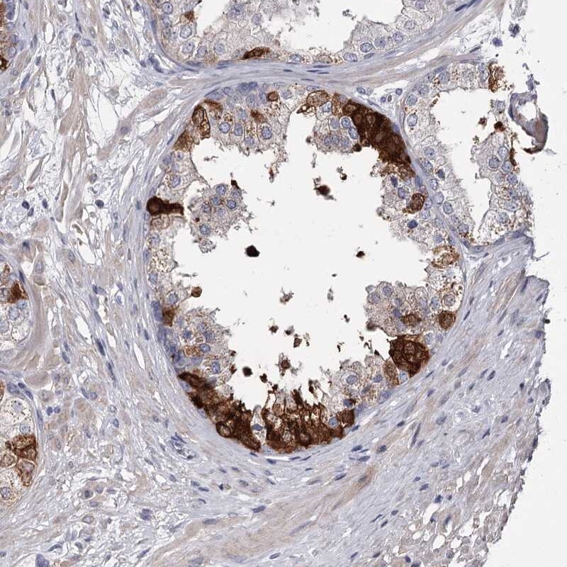 FDXACB1 Antibody - BSA Free Immunohistochemistry: FDXACB1 Antibody - BSA Free [NBP1-90460]