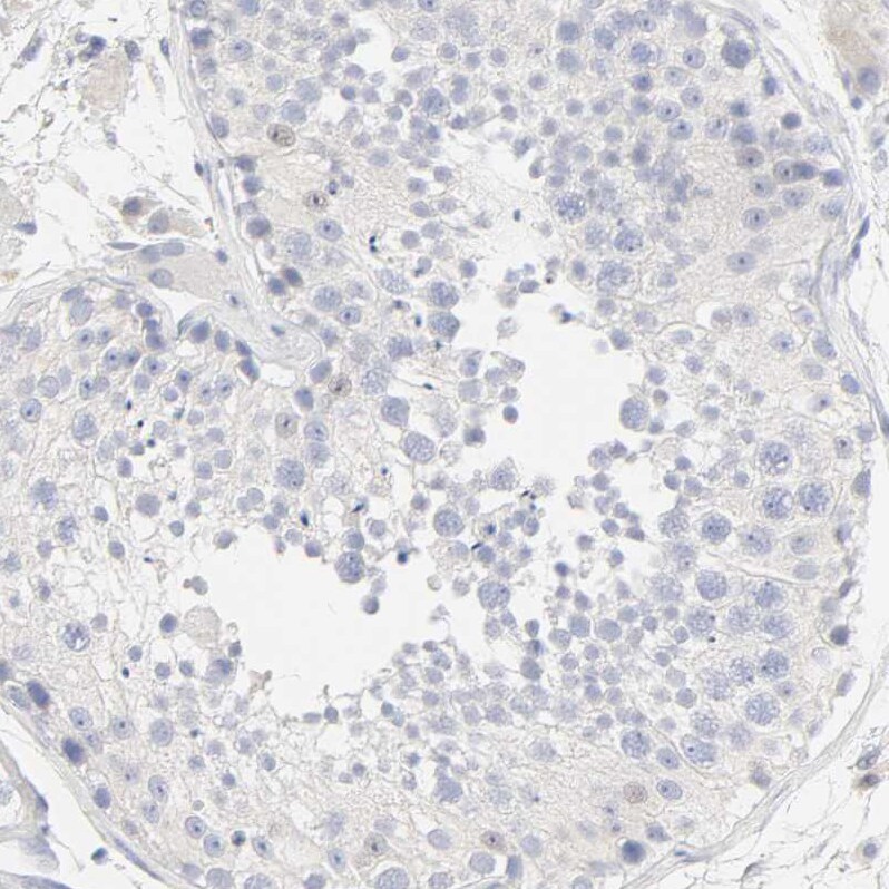 FCGBP Antibody - BSA Free Immunohistochemistry: FCGBP Antibody - BSA Free [NBP1-90461]
