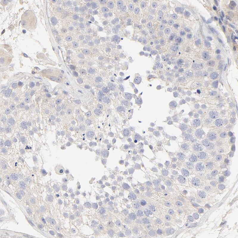 FCGBP Antibody - BSA Free Immunohistochemistry: FCGBP Antibody - BSA Free [NBP1-90462]