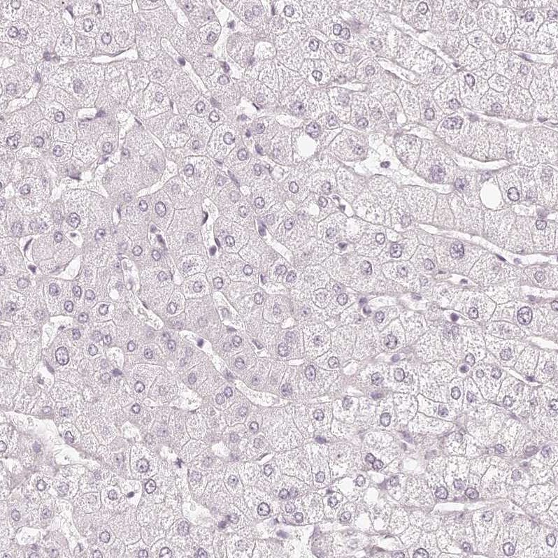EIG121 Antibody - BSA Free Immunohistochemistry: EIG121 Antibody - BSA Free [NBP1-90479]