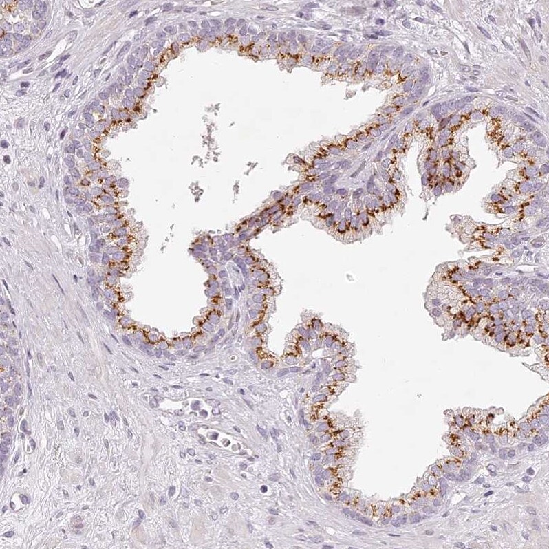 EIG121 Antibody - BSA Free Immunohistochemistry: EIG121 Antibody - BSA Free [NBP1-90479]
