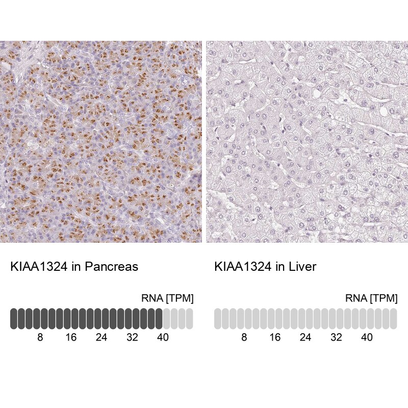 EIG121 Antibody - BSA Free Immunohistochemistry: EIG121 Antibody - BSA Free [NBP1-90479]