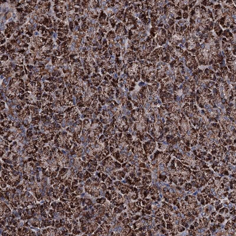 CHCHD8 Antibody - BSA Free Immunohistochemistry: CHCHD8 Antibody - BSA Free [NBP1-90483]