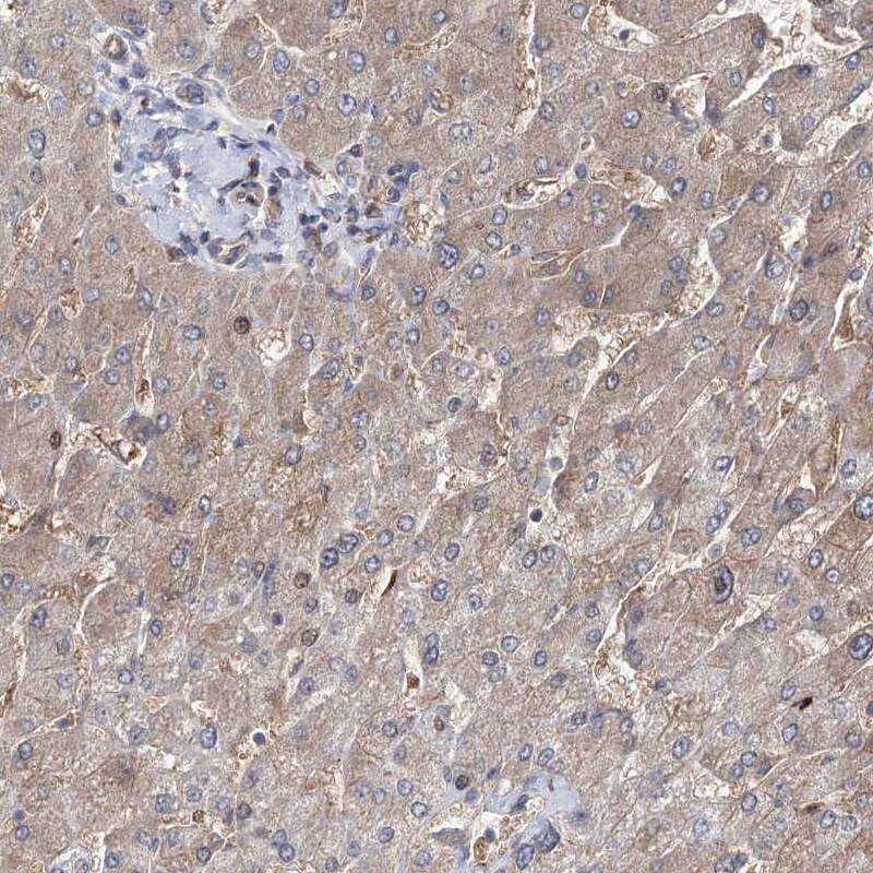 OTUD1 Antibody - BSA Free Immunohistochemistry-Paraffin: OTUD1 Antibody [NBP1-90484]