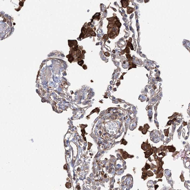OTUD1 Antibody - BSA Free Immunohistochemistry-Paraffin: OTUD1 Antibody [NBP1-90484]