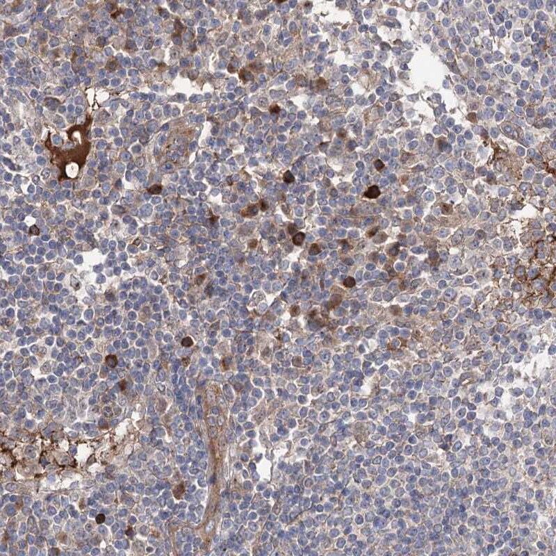 OTUD1 Antibody - BSA Free Immunohistochemistry-Paraffin: OTUD1 Antibody [NBP1-90484]